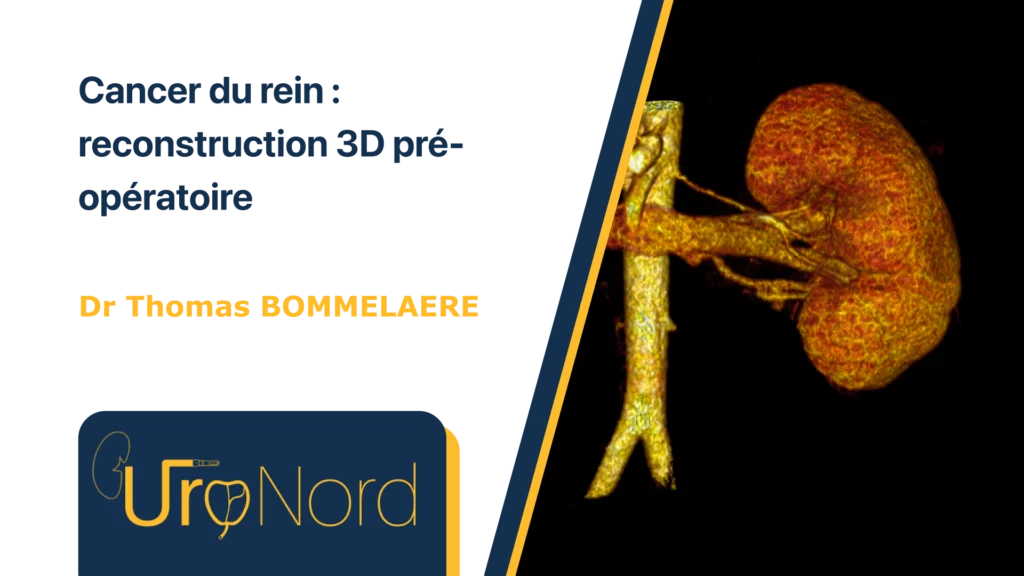 Reconstruction-Rein-3D Reconstruction en 3D du Rein