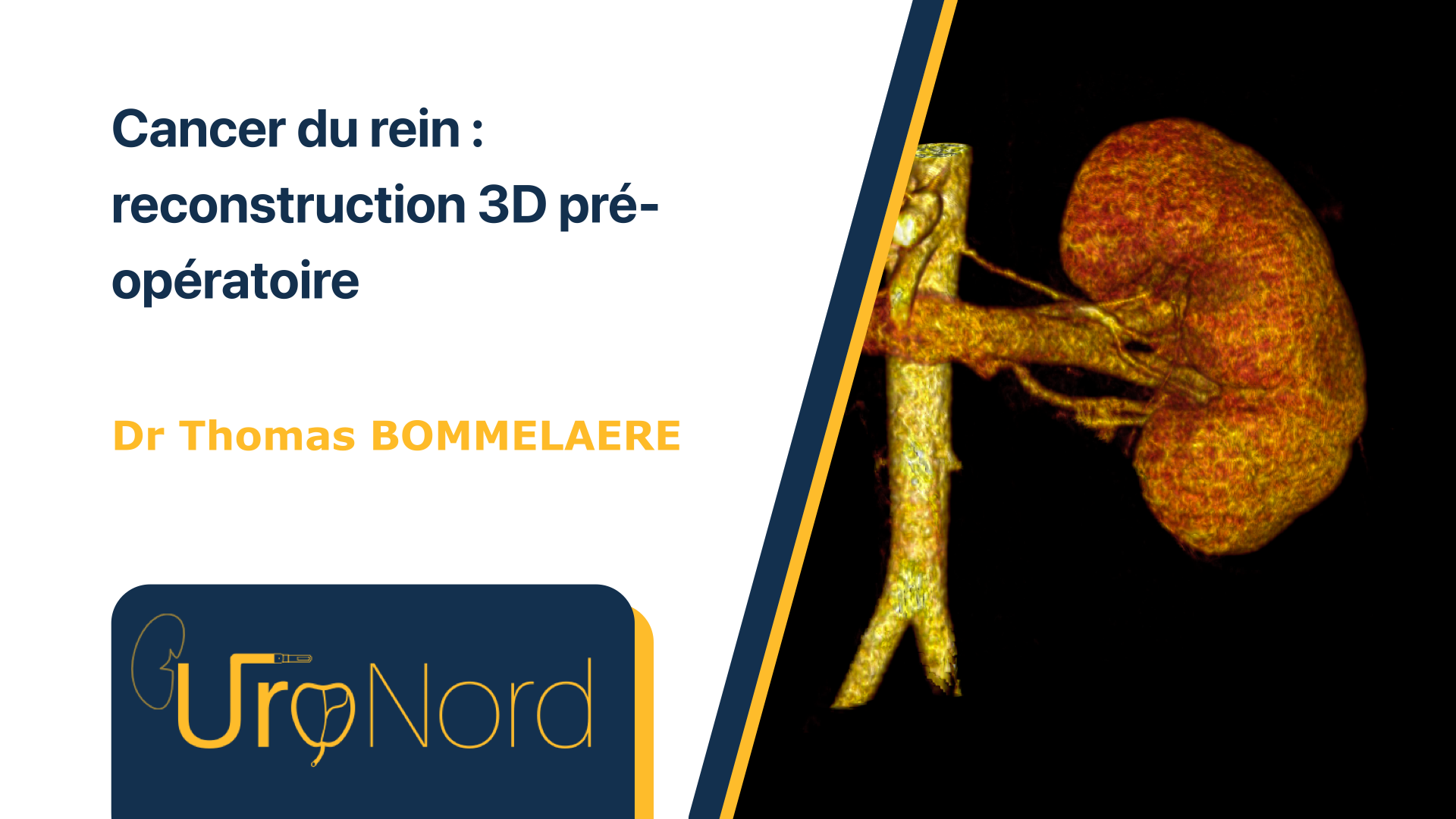 Reconstruction en 3D du Rein